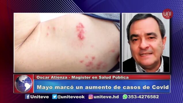 UNITEVE | Mayo marcó un aumento de casos de Covid – Oscar Atienza