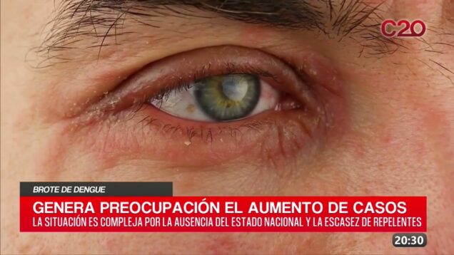 C20 Noticias | Brote de dengue – Ana Ceballos