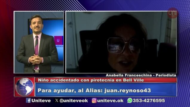 Uniteve Noticias | Bell Ville | Niño en terapia y con pronóstico reservado por pirotecnia