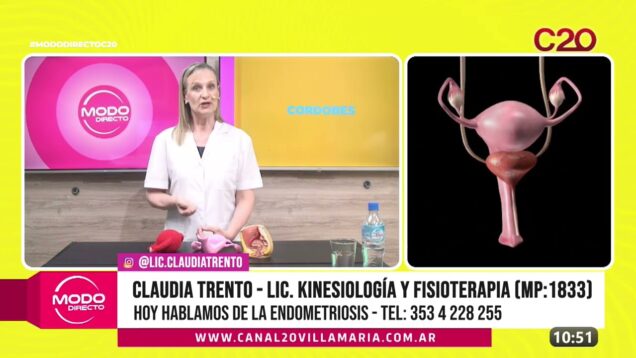 Modo Directo | Endiometriosis – Claudia Trento