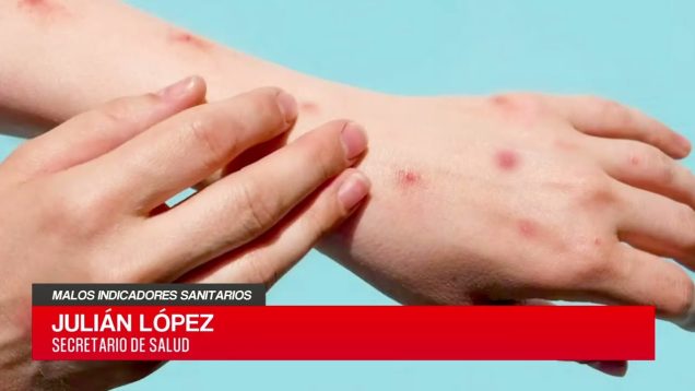 C20 Noticias | Malos indicadores sanitarios -Julián López