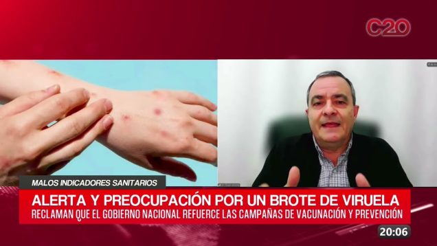 C20 Noticias | Malos indicadores sanitarios – Oscar Atienza